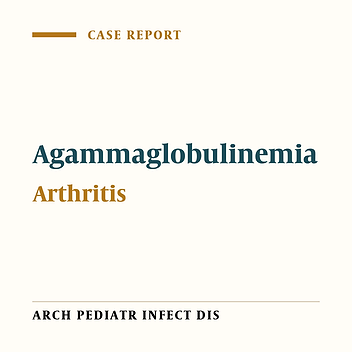 Bruton’s Disease Presenting With Arthritis; A Case Report