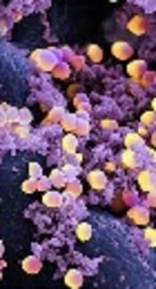 Investigation of Biofilm Formation Among Methicillin-Resistant Staphylococcus aureus Isolated from Children