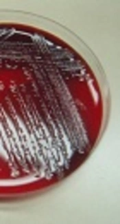 Epidemiological Aspects and Main Determinants of Prognosis in Children with Acinetobacter Infections Admitted to Intensive Care Units at Aliasghar Children's Hospital, Tehran, Iran