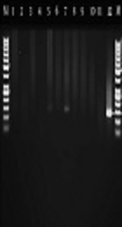 Molecular Identification and Genotyping of Toxoplasma Gondii in Blood and CSF Samples of Children with Immunodeficiency in Ahvaz, Southwest of Iran