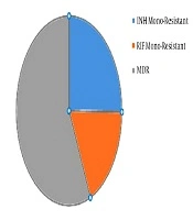 Evaluating the Frequency of Resistance to Pyrazinamide Among Drug-resistant Strains of Mycobacterium tuberculosis in Isfahan, Iran