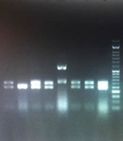 Comparison of Direct Sequencing with Real-time PCR High Resolution Melt and PCR Restriction Fragment Length Polymorphism Analysis to Identify Clinically Important Candida Species