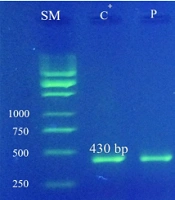 Molecular Diagnosis of Fungal Sinusitis Using Limit of Detection