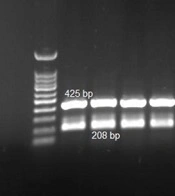 Antimicrobial Resistance, Integron Carriage, and Fluoroquinolone Resistance Genes in Acinetobacte baumannii Isolates