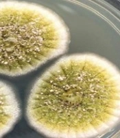 Effect of Voriconazole on Biofilm of Filamentous Species Isolated from Keratitis
