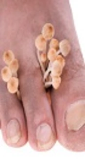 What Is the Most Recent Evidence on the Prevention and Early Treatment of Invasive Fungal Infections in Nonneutropenic Critically Ill Patients?