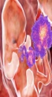 Zika Virus Infection during Pregnancy; Maternofetal Risk Assessment, Transmission, Complications, and Management: A Review of the Literature