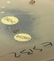 Molecular Analysis of Fosfomycin Resistance Among Escherichia coli Isolates from Urinary Tract Infections in Kidney Transplant Patients During 2019 - 2020