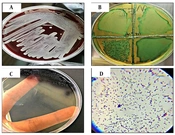 Effect of Ethanolic Extract of Syzygium aromaticum Plant Against Enterococcus faecalis Isolated from Women with Urinary Tract Infections