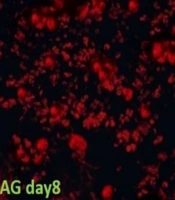 Cover image of the article: Adipose-derived Stem Cells Improving Inflammatory and Proliferative Responses in an Infected and Ischemic Ulcer Model in Type 1 Diabetic Rats: Insights Into Bacterial Count, Stereological Parameters, microRNA-21, and FGF2 Regulation