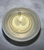 Severe Neuropathic Back Pain as the Initial Presentation in Angiostrongylus cantonensis Infection: The Role of ICU Management in Overcoming Diagnostic and Analgosedation Challenges