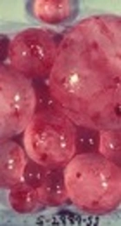 Hydatid Cyst Epidemiology in Khuzestan, Iran: A 15-year Evaluation