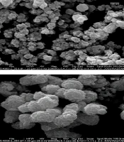 Comparable Antibacterial Effects of Silver and Iron Oxide Nanoparticles on Urinary Calculi Obtained After Percutaneous Nephrolithotomy