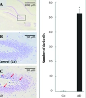 Assessment of Enterobacter, Clostridium, Lactobacillus, and Bifidobacterium Population in a Mouse Model of Alzheimer's Disease