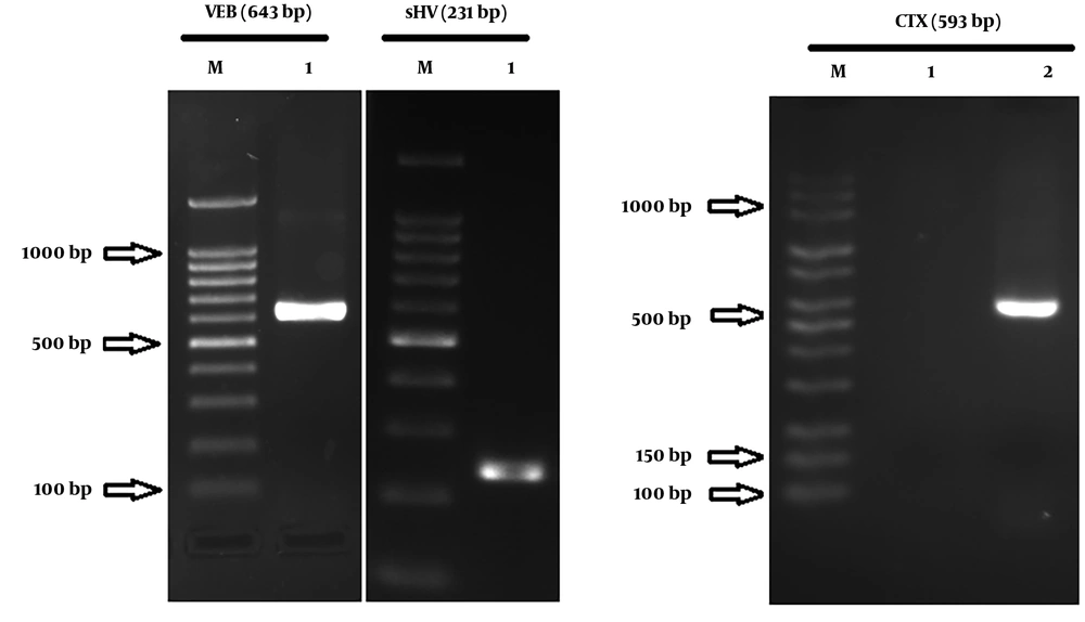 The Agarose Gel of the Strains Containing ESBL Genes The Agarose Gel of the Strains Containing ESBL Genes