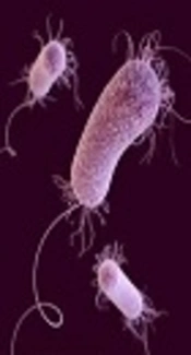 Extended-Spectrum Beta-Lactamases Producing Pseudomonas aeruginosa Isolated From Patients With Ventilator Associated Nosocomial Infection