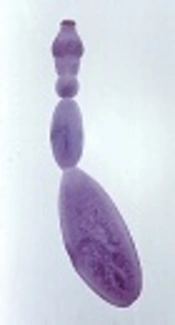 Discrimination of Mixed Infections of Echinococcus Species Based on in Silico Sequence Analysis: A New Way of Reflecting Overlapped Strains in Indigenous Areas