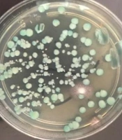 Comparative Study of Candida albicans Strains from Clinical and Environmental Sources in Iran