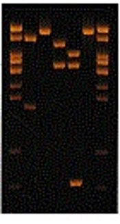 Cover image of the article: Molecular Identification of Nocardia Strains from the Soil by hsp65 Gene: Polymerase Chain Reaction-Restriction Fragment Length Polymorphism (RFLP) and Analysis of Sequence 16S rRNA Gene