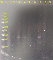 Molecular Identification and Genotyping of Pneumocystis jirovecii in Bronchoalveolar Lavage (BAL) Samples of Patients Admitted to the Intensive Care Unit of Eastern Iran