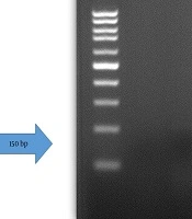 Investigation of IL-10 Expression Levels in Relation to HPV and HHV-6 Genomes in Uterine Endometrial Secretions from Women with Recurrent Implantation Failure