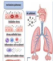 The Effect of Air Pollutants on Exacerbation of Pulmonary Tuberculosis: A Review
