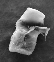 Oral Actinomycetes from HIV-Infected Patients in Tehran, Iran