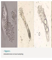 Identification of Demodex spp. (Acari: Demodicidae), Prevalence Human Demodicocis, Sociodemographic Characteristics and Associated Risk Factors in Ahvaz County, Southwestern Iran (2022 - 2023)