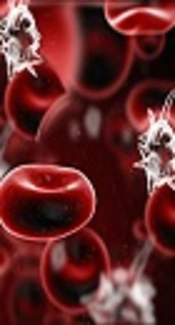 Procalcitonin May Not Discriminate Between Sepsis and Non-Infective Systemic Inflammatory Response Syndrome (SIRS) in Heterogonous Critically Ill Patients