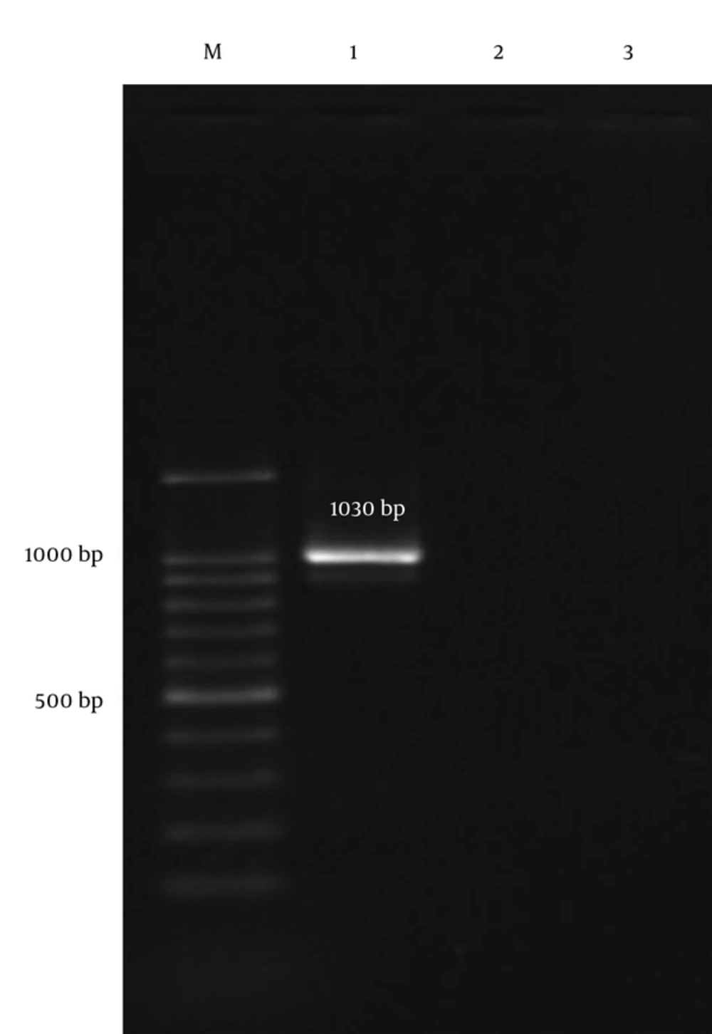A Representative Gel Image of <i>vanA</i> Gene Detection by PCR Lane 1: positive control; lane 2: a negative clinical isolates; lane 3: negative control (distilled water); M: 100 bp ladder.