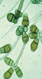 Isolation of Different Species of Candida in Patients with Vulvovaginal Candidiasis from Damavand, Iran
