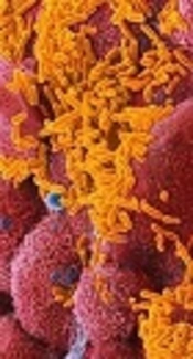 Study of Serologic Response Rate to Haemophilus influenzae Type B After Administration of the Third Dose of Pentavalent Vaccine in Children Aged 12 Months in Karaj City in 2016