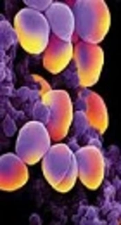 Characterization of Virulence Factors and Prophage Profiles of Methicillin-Resistant Staphylococcus aureus Strains Isolated from a Referral Hospital in Tehran, Iran