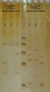 Prevalence of Nontuberculous Mycobacteria: A Single Center Study in Tehran, Iran