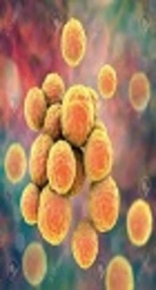 High Frequency of Methicillin-Resistant <i>Staphylococcus aureus</i> in Intensive Care Unit in Karaj, Iran
