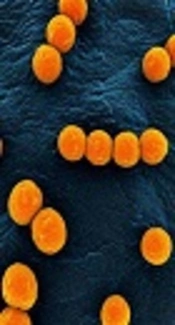 High-level Gentamicin Resistance and Detection of aac (6’)Ie-aph (2”)Ia Gene in Enterococci Isolated from Pediatric Hospital in Northwest of Iran