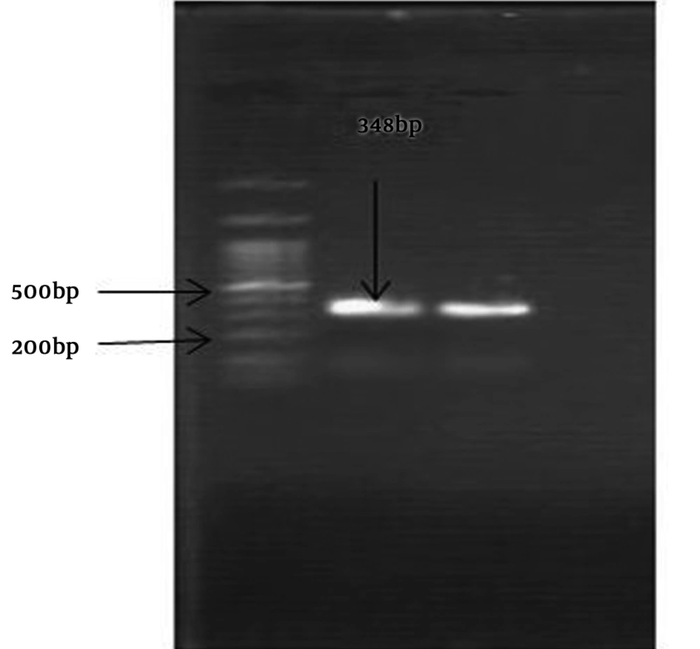 Amplification of a 348-bp DNA fragment of the ply gene from <i>S. pneumonia</i> Amplification of a 348-bp DNA fragment of the ply gene from <i>S. pneumonia</i>