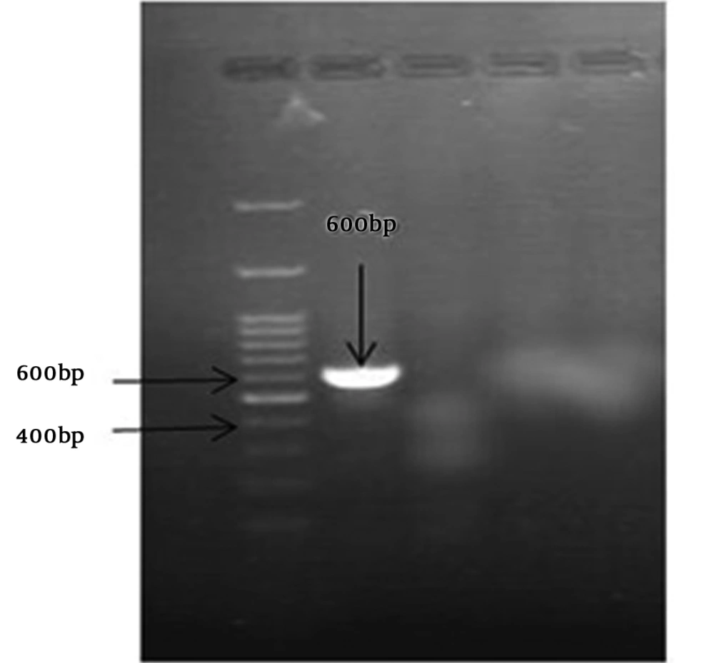 Amplification of a 600-bp DNA fragment of <i>Men1</i> gene from <i>N. meningitidis</i> Amplification of a 600-bp DNA fragment of <i>Men1</i> gene from <i>N. meningitidis</i>
