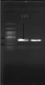 Cover image of the article: A Rare Case of Pneumococcal and Meningococcal Mixed Meningitis in an Infant with Cardiac Dysfunction