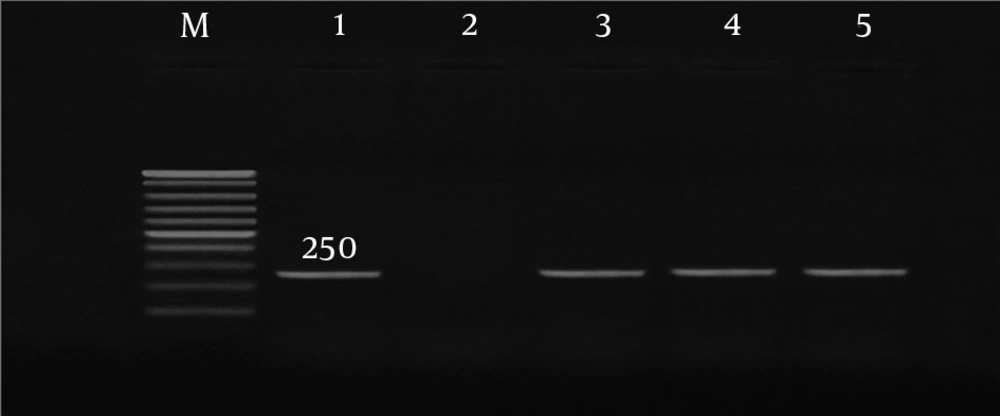 PCR products of <i>omp</i> encoding gene in <i>C. trachomatis</i> (250 bp), Lane 1, positive control; lanes 3 - 5 positive samples; lane 2, negative control; Lane M, 100 bp size marker. PCR products of <i>omp</i> encoding gene in <i>C. trachomatis</i> (250 bp), Lane 1, positive control; lanes 3 - 5 positive samples; lane 2, negative control; Lane M, 100 bp size marker.