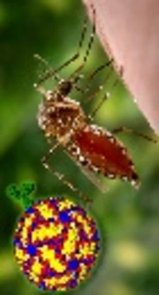 Junctional Rhythm in a Child with Dengue Shock Syndrome