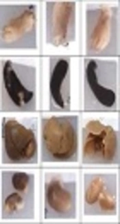 In Vivo Therapeutic Effects of Four Synthesized Antileishmanial Nanodrugs in the Treatment of Leishmaniasis