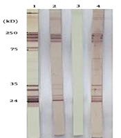 Archives of Clinical Infectious Diseases