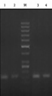 Development and Validation of Heminested RT-PCR and qRT-PCR Assays for Comprehensive Detection of Rabies Virus in the Suspected Rabid Brain and Saliva Samples