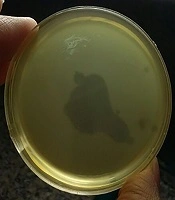 Characterizing a Lytic Bacteriophage Infecting Methicillin-Resistant Staphylococcus aureus (MRSA) Isolated From Burn Patients