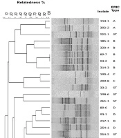 Genetic Diversity of OXA Producing Carbapenem-Resistant Acinetobacter baumannii from Environment of Tertiary Hospitals in Central Iran
