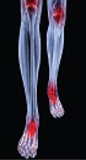 Are Lower Extremity Injuries Related to Spinal form Abnormalities in Professional Football Players? A Prospective Cohort Study