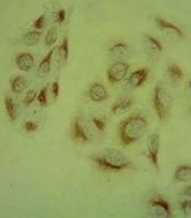 Fibrin Nanoparticles as a Promising Anti-cancer Activity on MCF-7 Cells