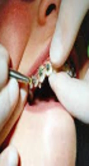 Cover image of the article: General Self-Efficacy and Self-Perceived Confidence of Dental Students in Performing Orthodontic Clinical Skills