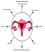 Exploring the Impact of Psychological Stress on Endometriosis